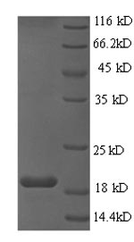 Recombinant Human papillomavirus type 16 Protein E6(E6)