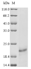 Recombinant Human papillomavirus type 16 Protein E7(E7)