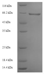 Recombinant Rabies virus Glycoprotein(G),partial