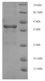 Recombinant Escherichia coli Tetracycline repressor protein class B from transposon Tn10(tetR)