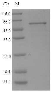 Recombinant Porphyromonas gingivalis Lys-gingipain(kgp),partial