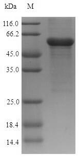 Recombinant Human Acid ceramidase(ASAH1)