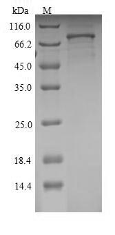 Recombinant Rat Semaphorin-3A(Sema3a)