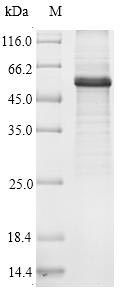 Recombinant Human Beclin 1-associated autophagy-related key regulator(ATG14)