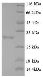 Recombinant Human Forkhead box protein P3(FOXP3),partial 