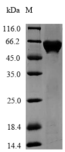 Recombinant Agrobacterium sp. 3-phosphoshikimate 1-carboxyvinyltransferase(aroA)