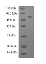 Recombinant Human Muscleblind-like protein 1(MBNL1)