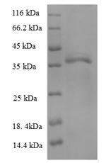 Recombinant Human HLA-B protein(HLA-B),partial