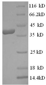 Recombinant Human Mast cell carboxypeptidase A(CPA3)