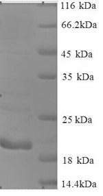 Recombinant Human Cancer/testis antigen 1(CTAG1A)