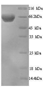 Recombinant Human Interferon-induced, double-stranded RNA-activated protein kinase(EIF2AK2)