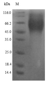 Recombinant Human Estrogen receptor(ESR1),partial