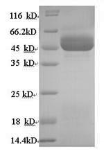 Recombinant Human 11-beta-hydroxysteroid dehydrogenase type 2(HSD11B2)