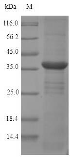 Recombinant Rat Monoglyceride lipase(Mgll)