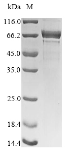 Recombinant Human Nucleolin(NCL),Partial