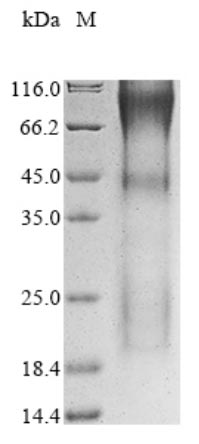 Recombinant Human Transcriptional coactivator YAP1(YAP1)