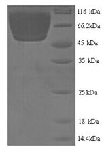 Recombinant Mouse Carboxylesterase 1C(Ces1c),partial