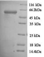 Recombinant Porphyromonas gingivalis Gingipain R1(rgpA),partial