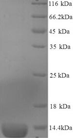 Recombinant Mouse Serum amyloid A-3 protein(Saa3) 