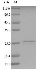 Recombinant Human Kita-kyushu lung cancer antigen 1(CT83) 