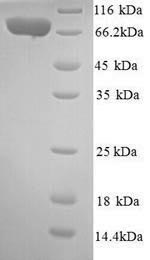 Recombinant Human Interleukin-12 receptor subunit beta-2(IL12RB2),partial