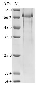 Recombinant Human Polycystin-1(PKD1),partial