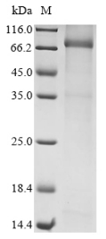 Recombinant Human Mannan-binding lectin serine protease 2(MASP2)