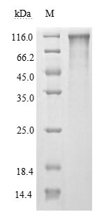 Recombinant Human Novel Coronavirus Spike glycoprotein(S),partial (Active)