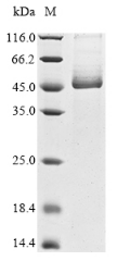 Recombinant Human Transmembrane protease serine 2(TMPRSS2),partial (Active)