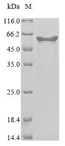 Recombinant Human coronavirus OC43 Nucleoprotein(N)