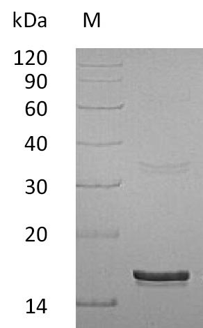 Recombinant Human Interferon gamma(IFNG) (Active)